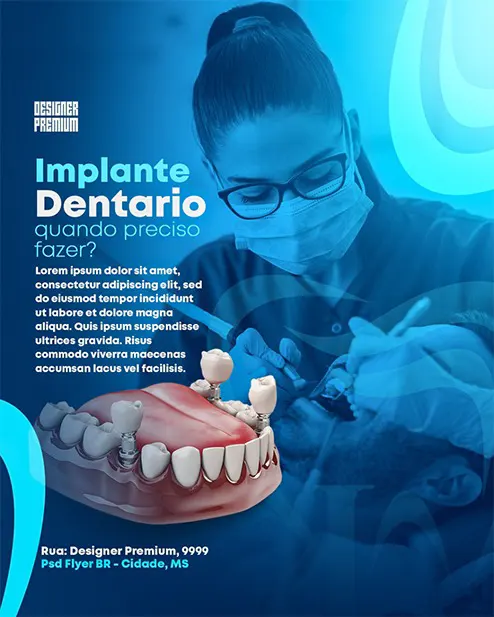 PSD FLYER FREE - TEMPLATE - CANVA - FREEPIK - DESIGNI - DESIGNER - IMPLANTE - DENTISTA - ODONTOLOGIA - CLINICA - CONSULTA - SOCIAL MEDIA - MIDIA SOCIAIS